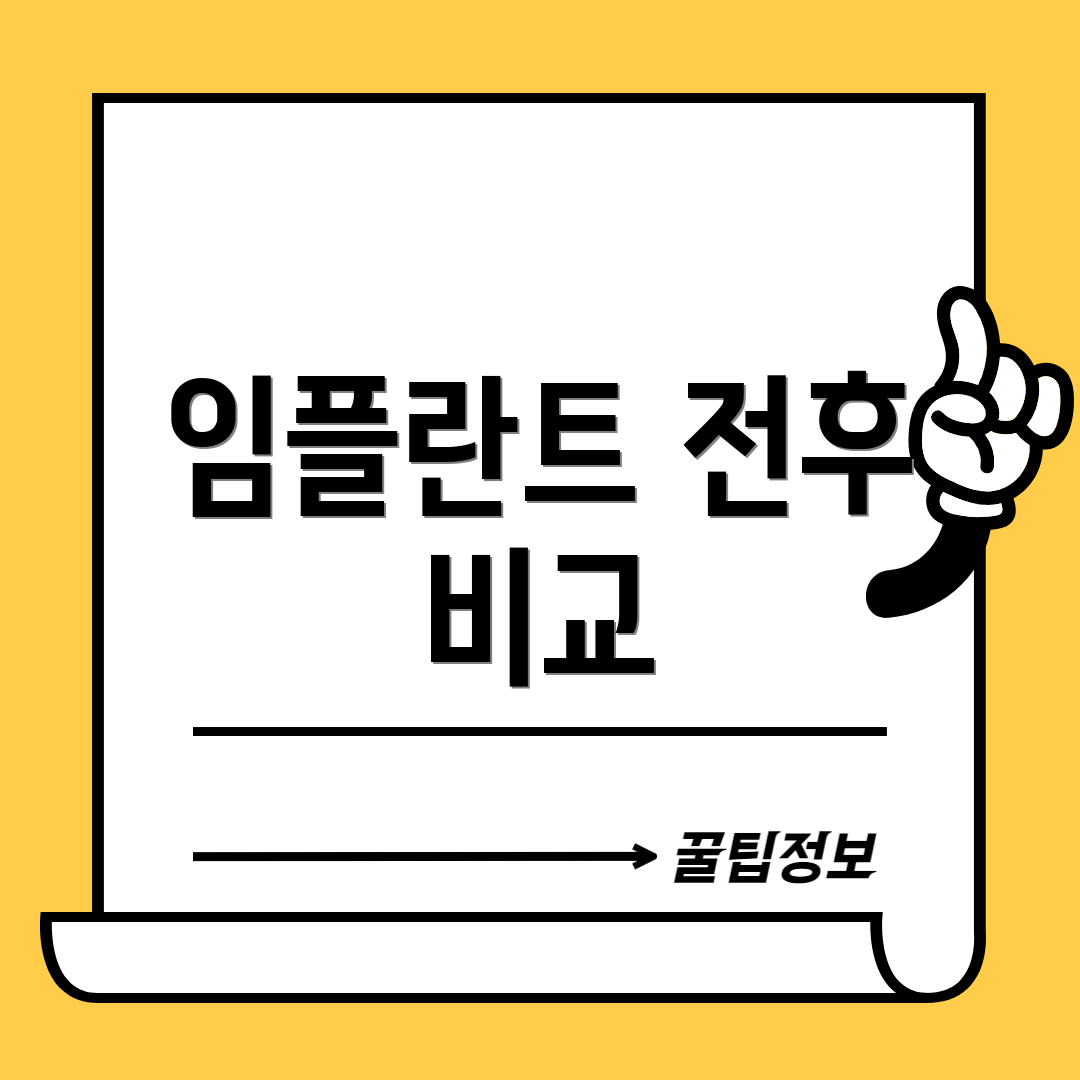 임플란트 전후 비교